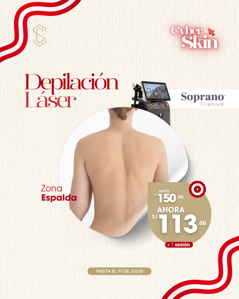 Depilación Láser - Espalda