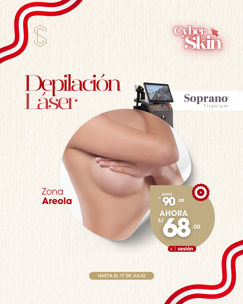 Depilación Láser - Areola