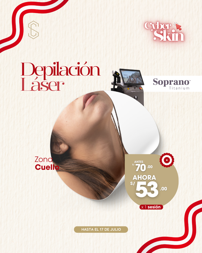 Depilación Láser - Cuello