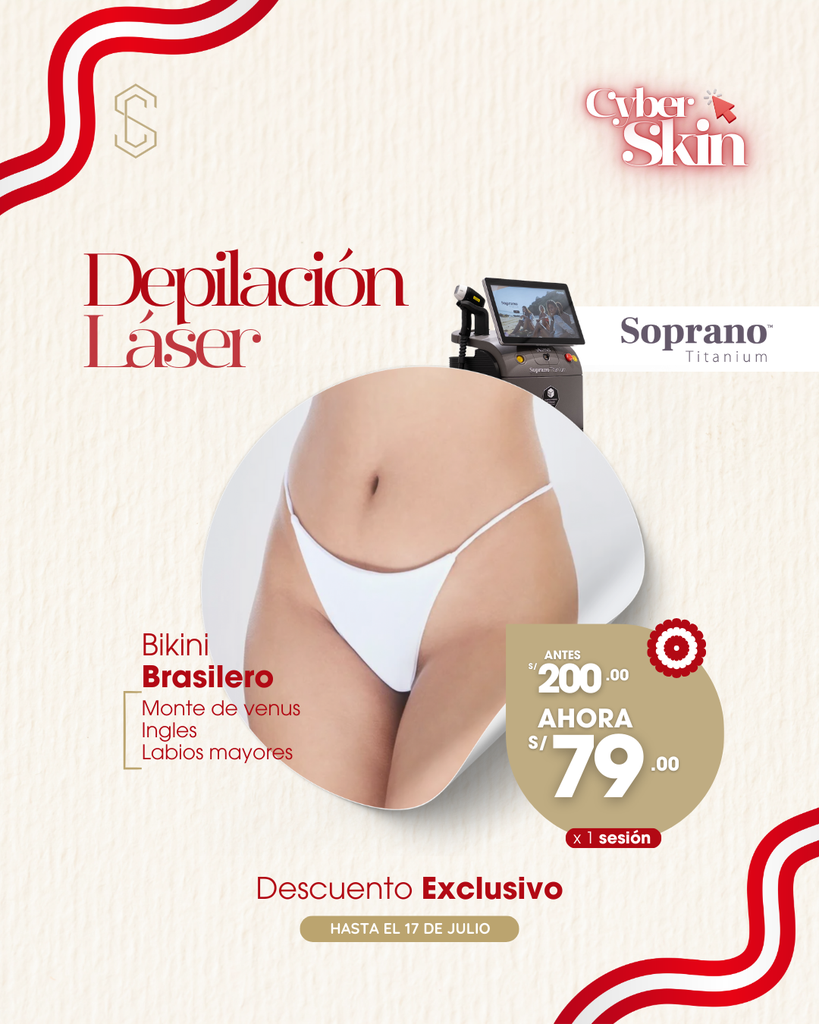 Depilación Láser - Bikini Brasilero