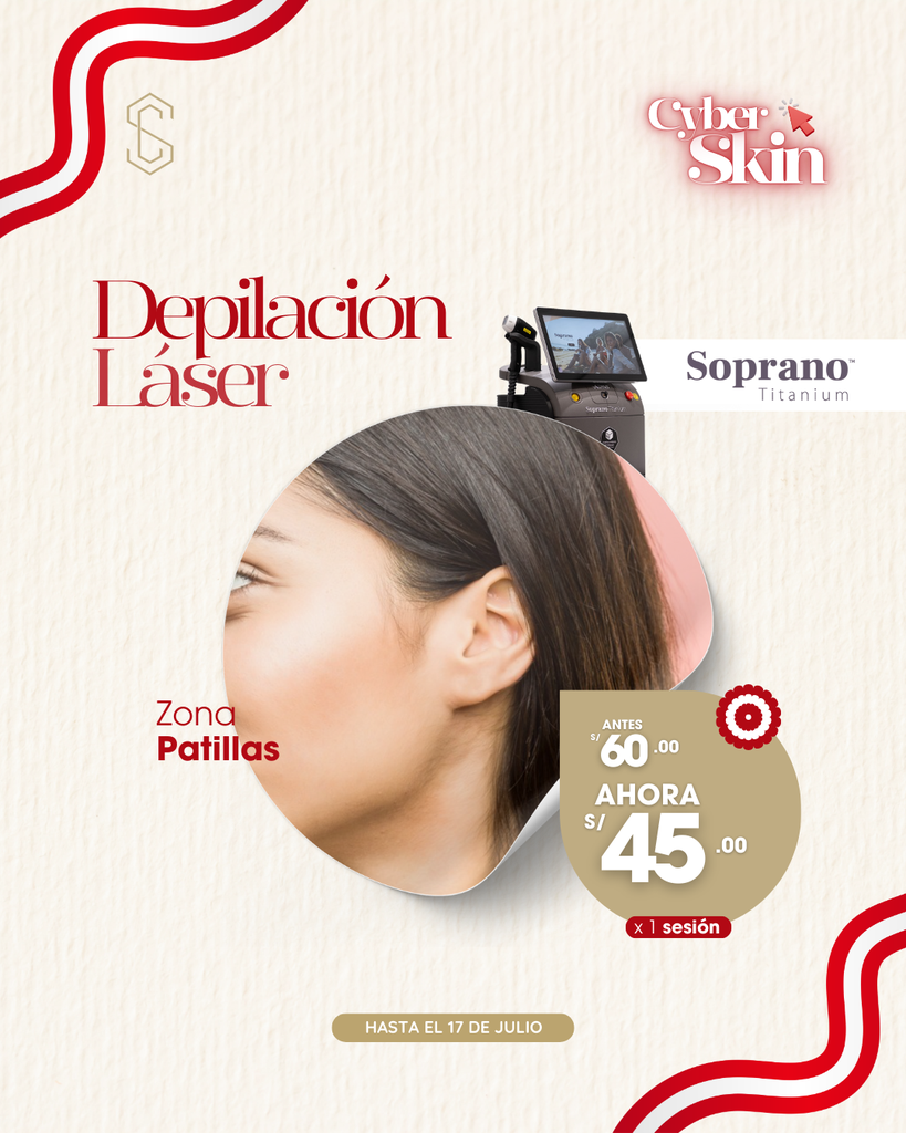 Depilación Láser - Patillas