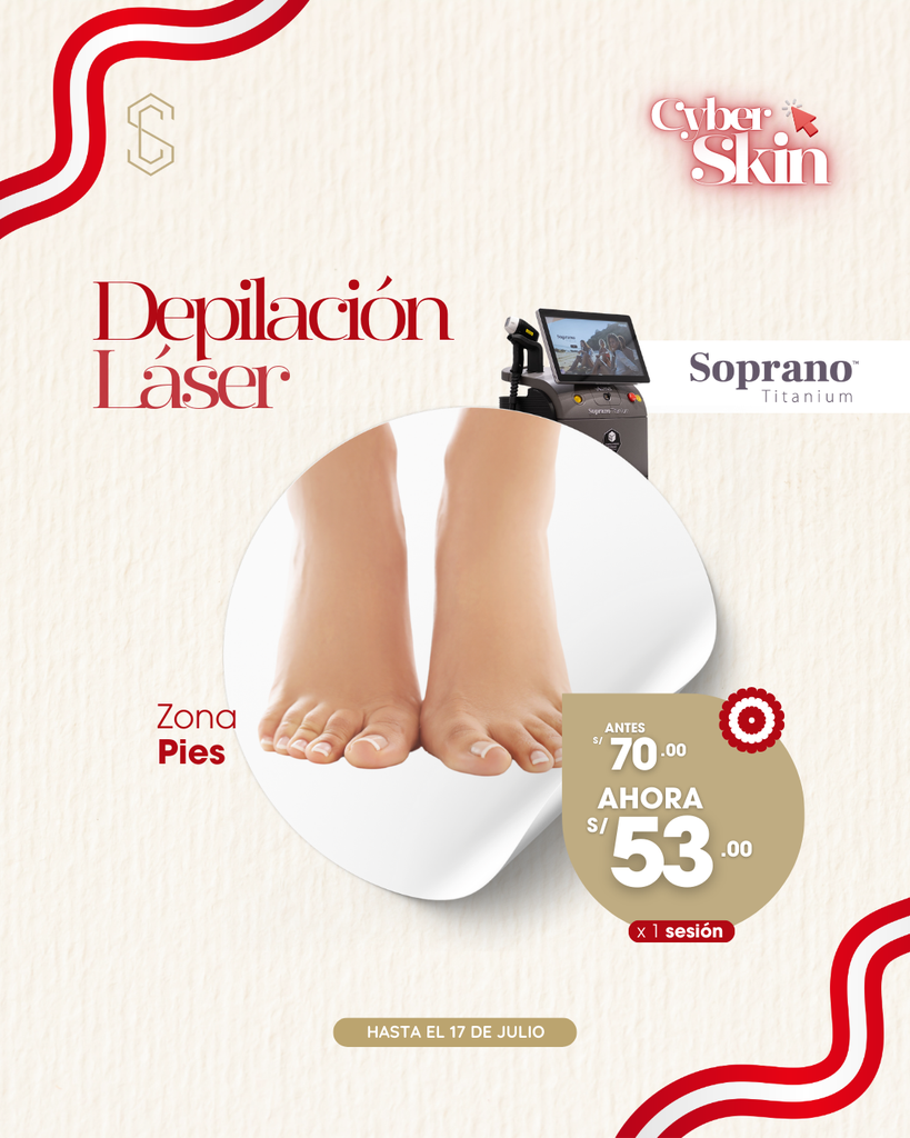 Depilación Láser - Pies