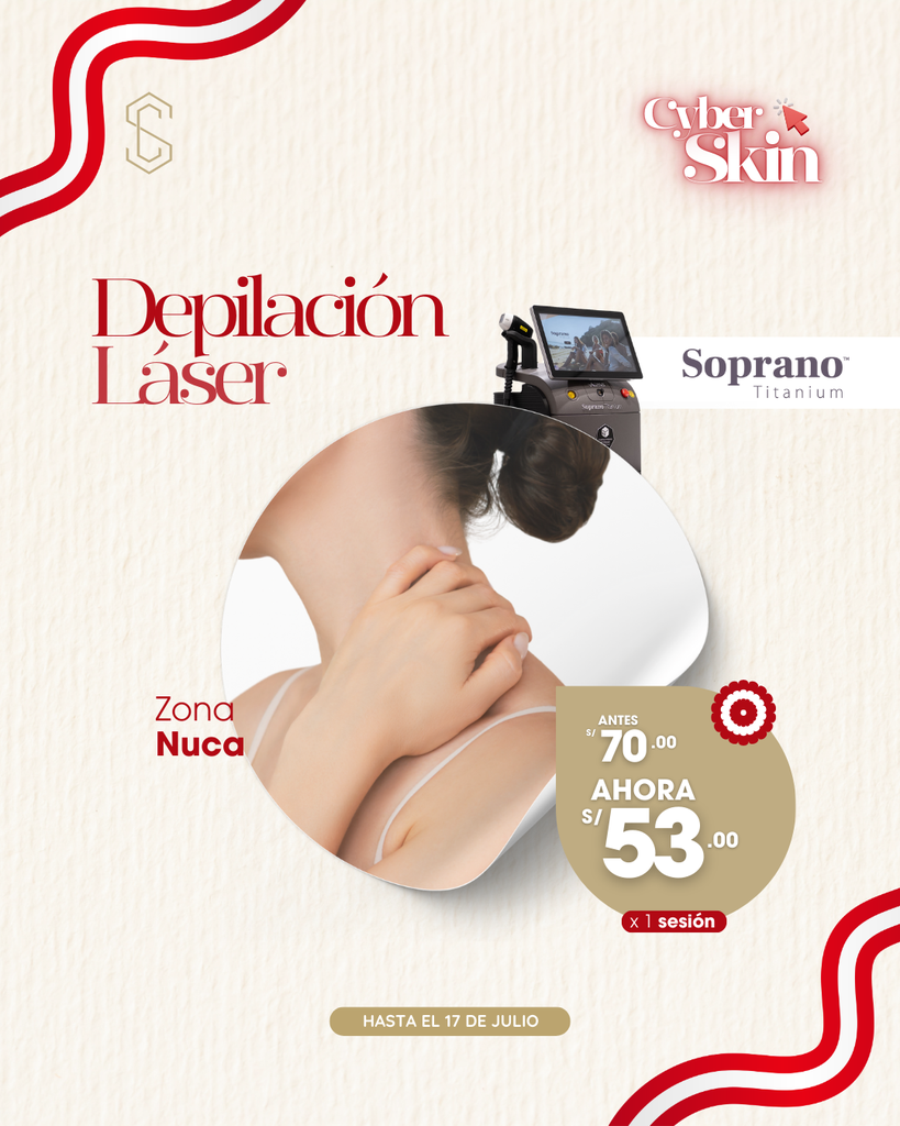 Depilación Láser - Nuca