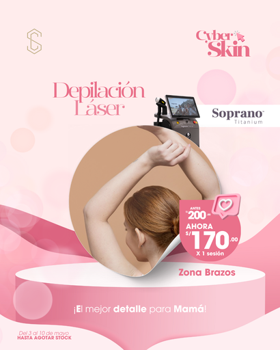 Depilación Láser - Brazos